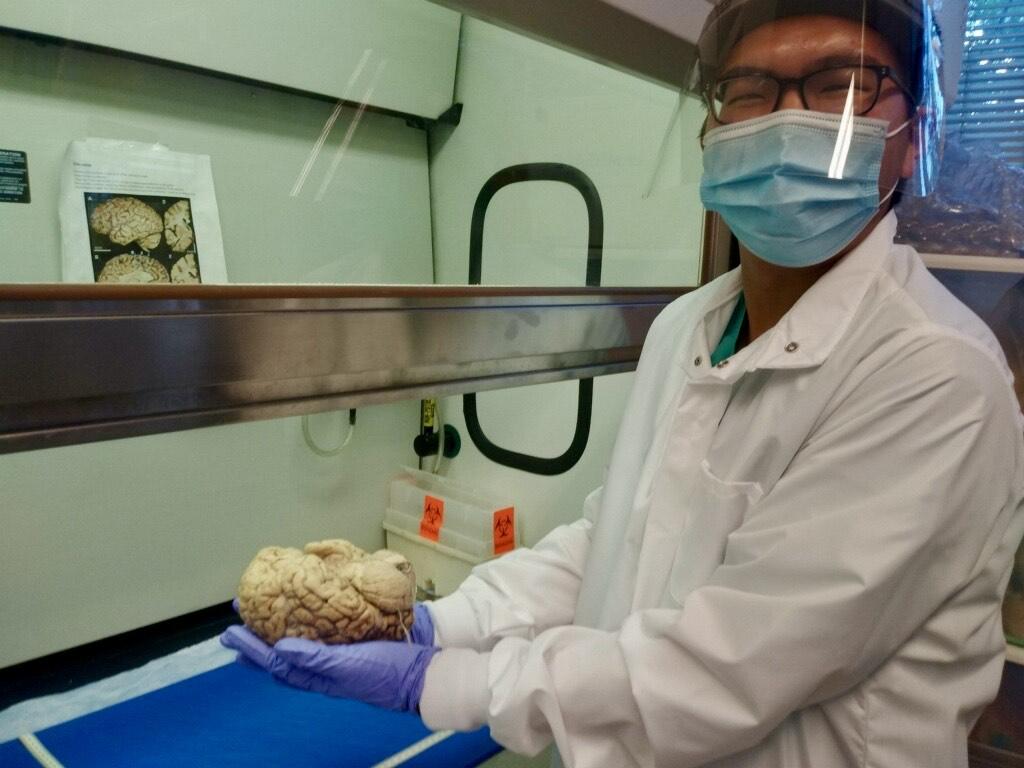 Jeff Lai holding a brain as part of a class dissection.